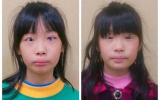 用嘴呼吸真的会让颜值崩塌吗？