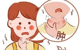甲状腺炎有哪些表现，如何诊断、治疗？