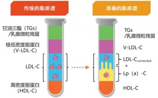 Lp（a）检测没有必要？